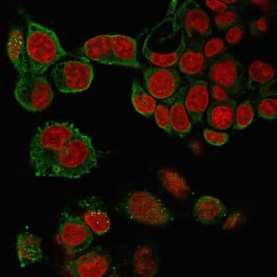 Immunocytochemistry/ Immunofluorescence: TNF-alpha Antibody (4C6-H8) [NBP2-34301]