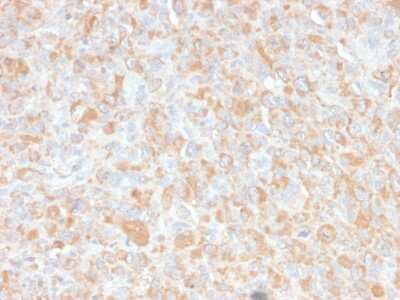 Immunohistochemistry-Paraffin: TNF-alpha Antibody (4C6-H8) [NBP2-34301]