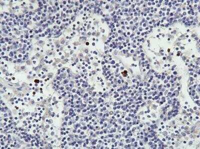 Immunohistochemistry-Paraffin: TNF-alpha Antibody (52B83) [NB600-1422]