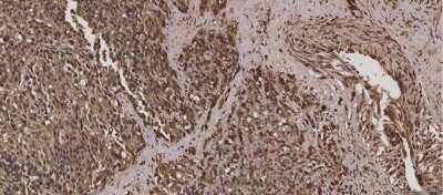 Immunohistochemistry: TNF-alpha Antibody [NBP2-44062]