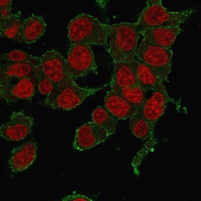 Immunocytochemistry/ Immunofluorescence: TNF-alpha Antibody (P/T2) [NBP2-34302]