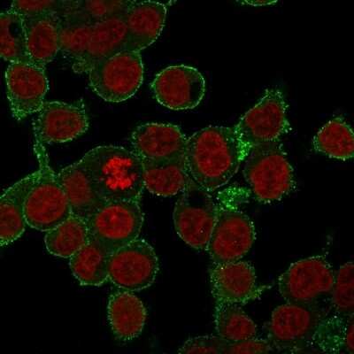 Immunocytochemistry/ Immunofluorescence: TNF-alpha Antibody (SPM543) [NBP2-34372]