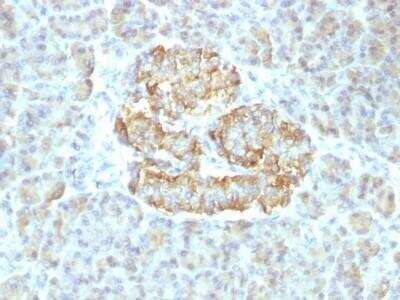 Immunohistochemistry-Paraffin: TNF-alpha Antibody (TNF/1500R) - Azide and BSA Free [NBP3-11621]