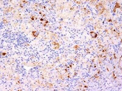 Immunohistochemistry-Paraffin: TNF-alpha Antibody (TNF706 + P/T2) - IHC-Prediluted [NBP2-48471]