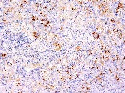 Immunohistochemistry-Paraffin: TNF-alpha Antibody (TNF706 + P/T2) [NBP2-34304]