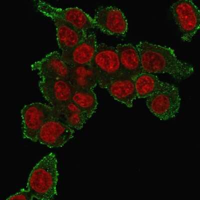 Immunocytochemistry/ Immunofluorescence: TNF-alpha Antibody (TNF706) [NBP2-34303]