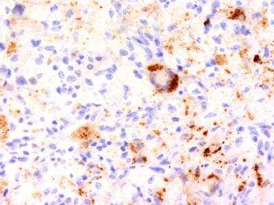 Immunohistochemistry-Paraffin: TNF-alpha Antibody (TNF706) [NBP2-34303]