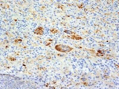 Immunohistochemistry-Paraffin: TNF-alpha Antibody (TNFA/1172) - Azide and BSA Free [NBP2-47675]