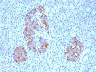 Immunohistochemistry-Paraffin: TNF-alpha Antibody (TNFA/1172) - IHC-Prediluted [NBP2-48470]