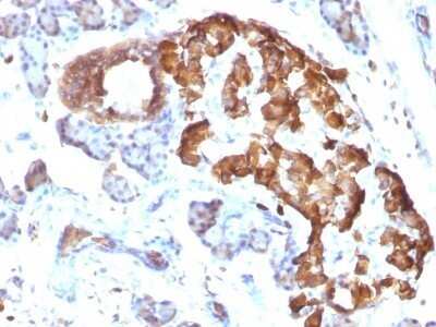Immunohistochemistry-Paraffin: TNF-alpha Antibody (TNFA/1172) - IHC-Prediluted [NBP2-48470]