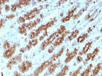 Immunohistochemistry-Paraffin: TNF-alpha Antibody (TNFA/1172) [NBP2-45331]