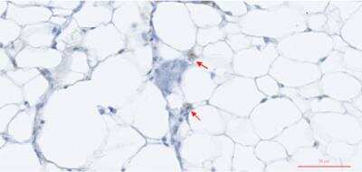 Immunohistochemistry: TNF-alpha Antibody (Z74P2C5*A12) - BSA Free [NBP2-61611]