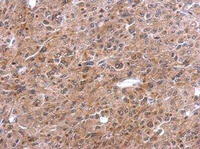 Immunohistochemistry-Paraffin: TNFAIP2 Antibody [NBP1-33480]