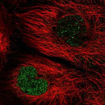 Immunocytochemistry/ Immunofluorescence: TNFAIP8 Antibody [NBP2-33814]