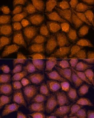 Immunocytochemistry/ Immunofluorescence: TNFAIP8L2 Antibody - Azide and BSA Free [NBP2-93009]