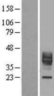 Western Blot: CD30 Ligand/TNFSF8 Overexpression Lysate [NBL1-17170]