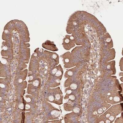Immunohistochemistry-Paraffin: TNIP1 Antibody [NBP1-89306]