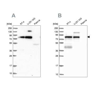 Western Blot: TNIP1 Antibody [NBP1-89306]