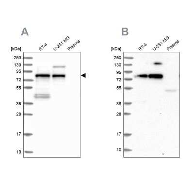 Western Blot: TNIP1 Antibody [NBP2-32705]