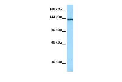 Western Blot: TNN Antibody [NBP2-85966]
