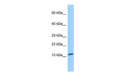 Western Blot: TNNC2 Antibody [NBP2-85967]