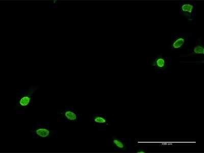 Immunocytochemistry/ Immunofluorescence: TNNI3K Antibody [H00051086-D01P]