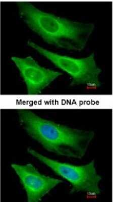 Immunocytochemistry/ Immunofluorescence: TNNI3K Antibody [NBP1-32837]