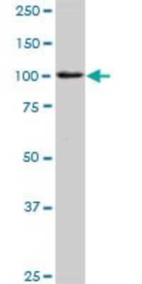 Western Blot: TNNI3K Antibody [H00051086-D01P]