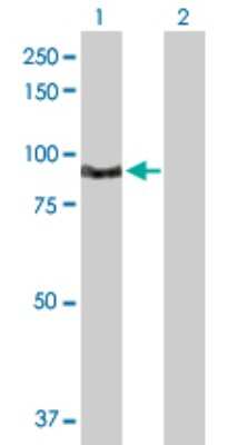 Western Blot: TNNI3K Antibody [H00051086-D01P]