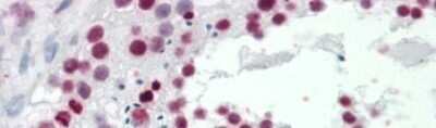 Immunohistochemistry: TNP1 Antibody [NBP1-55356]