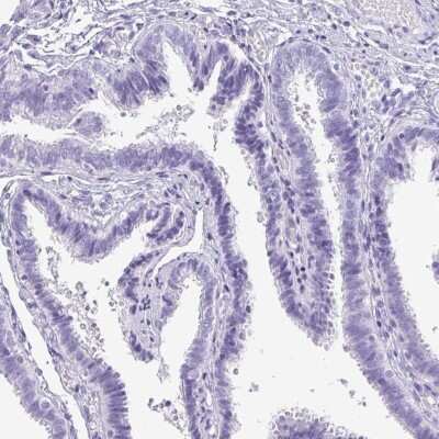 Immunohistochemistry-Paraffin: TNP1 Antibody [NBP2-30567]