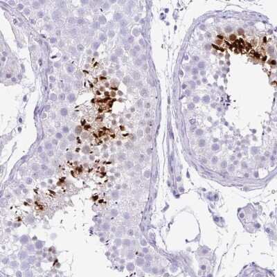 Immunohistochemistry-Paraffin: TNP1 Antibody [NBP2-30567]