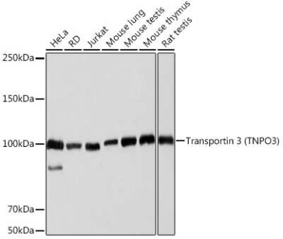 Western Blot: TNPO3 Antibody (0U3Q1) [NBP3-15908]