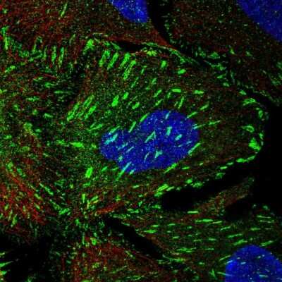 Immunocytochemistry/ Immunofluorescence: TNS3 Antibody [NBP2-37952]