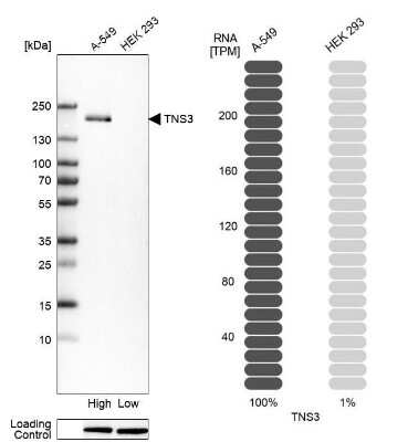 Western Blot: TNS3 Antibody [NBP2-37948]