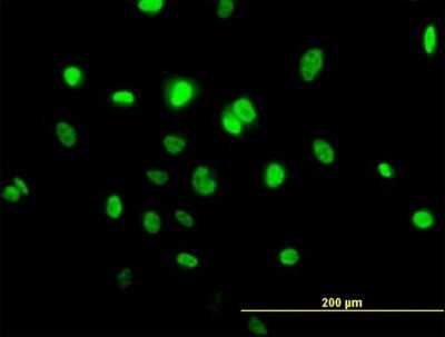 Immunocytochemistry/ Immunofluorescence: TOB1 Antibody [H00010140-B01P]