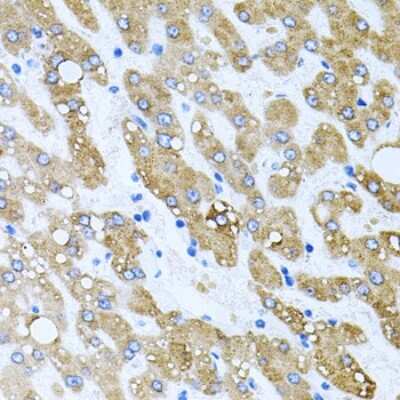 Immunohistochemistry-Paraffin: TOB2 Antibody - BSA Free [NBP2-93026]