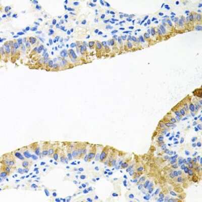 Immunohistochemistry-Paraffin: TOB2 Antibody - BSA Free [NBP2-93026]