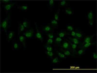 Immunocytochemistry/ Immunofluorescence: TOE1 Antibody (1C12) [H00114034-M02]
