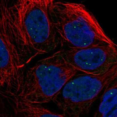 Immunocytochemistry/ Immunofluorescence: TOE1 Antibody [NBP2-49587]