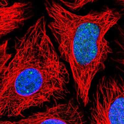 Immunocytochemistry/ Immunofluorescence: TOE1 Antibody [NBP2-56752]