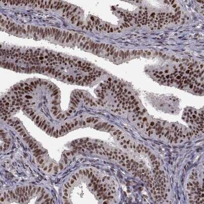 Immunohistochemistry: TOE1 Antibody [NBP2-49587]