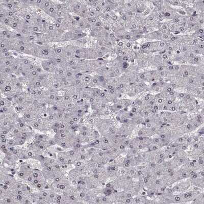 Immunohistochemistry-Paraffin: TOE1 Antibody [NBP2-49587]