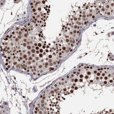 Immunohistochemistry-Paraffin: TOE1 Antibody [NBP2-49587]