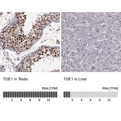 Immunohistochemistry-Paraffin: TOE1 Antibody [NBP2-49587]