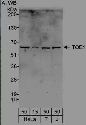 Immunoprecipitation: TOE1 Antibody [NBP2-04022]