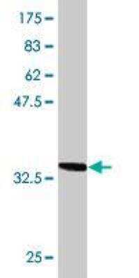 Western Blot: TOM1 Antibody (1C5) [H00010043-M06]