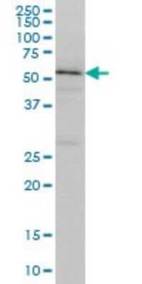 Western Blot: TOM1 Antibody (5A3) [H00010043-M01]