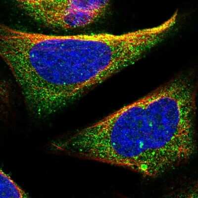 Immunocytochemistry/ Immunofluorescence: TOM1 Antibody [NBP2-55152]