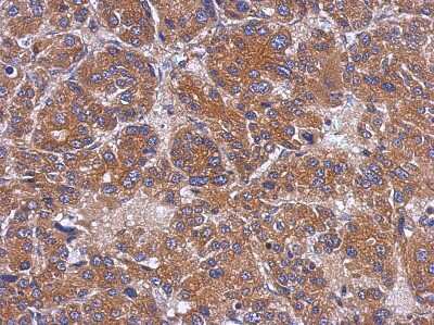 Immunohistochemistry-Paraffin: TOM1L1 Antibody [NBP2-20680]